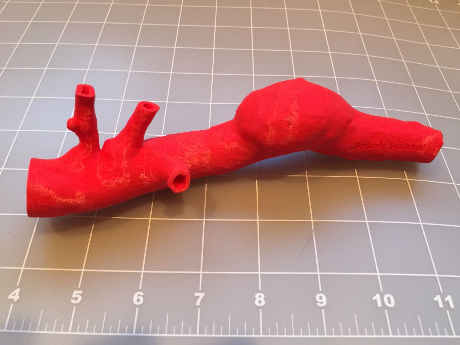 Life size 3D printed abdominal aortic aneurysm model