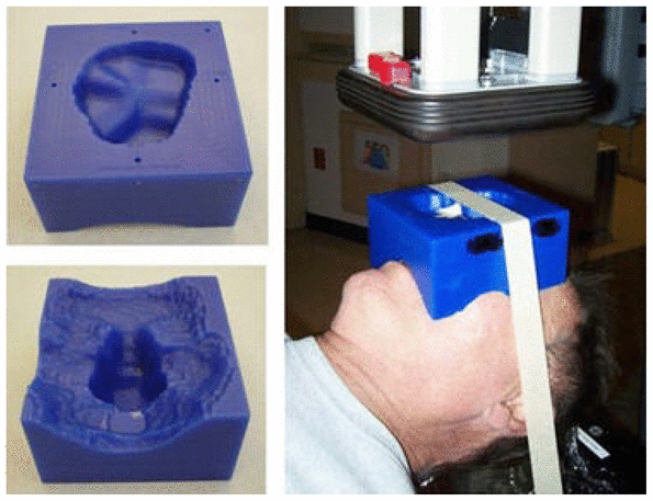 3D printed shield