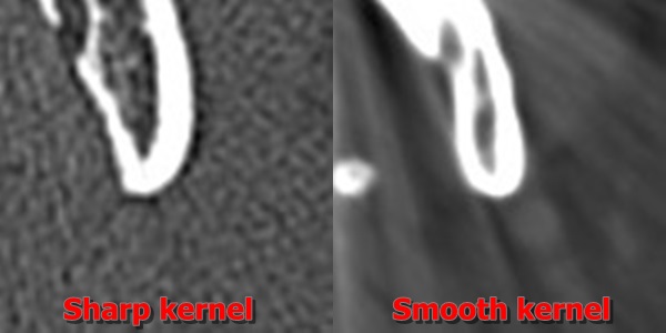 kernel zoom labeled