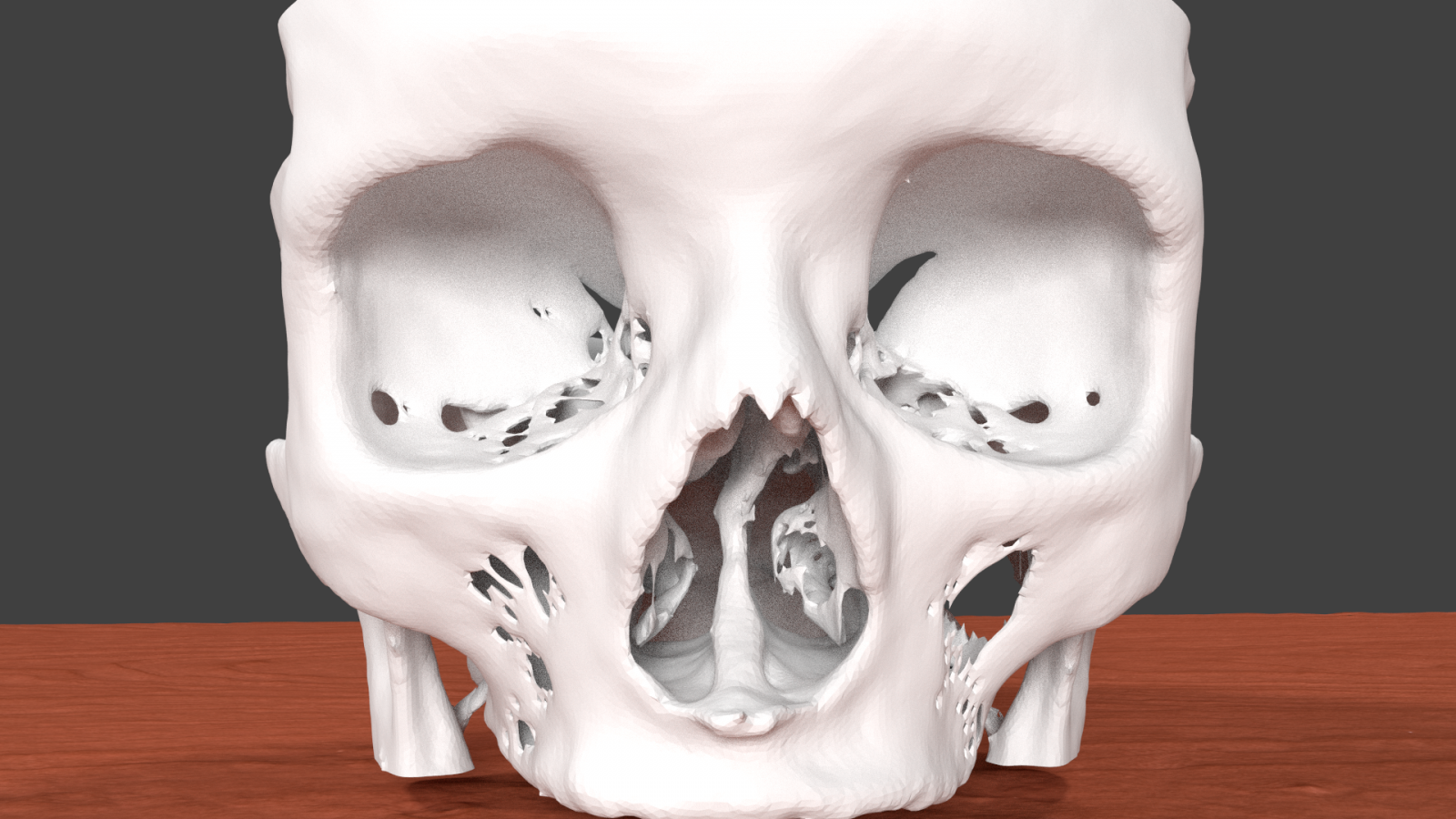 skull base HD