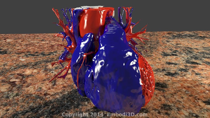 3D printable heart