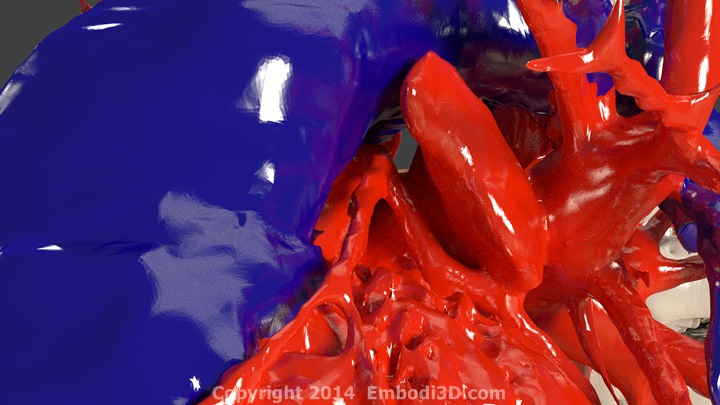 3D printable heart, coronary artery close up