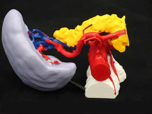 human splenic artery and spleen model designed for a medical device company