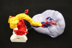 3D printed Model for Medical Device Development